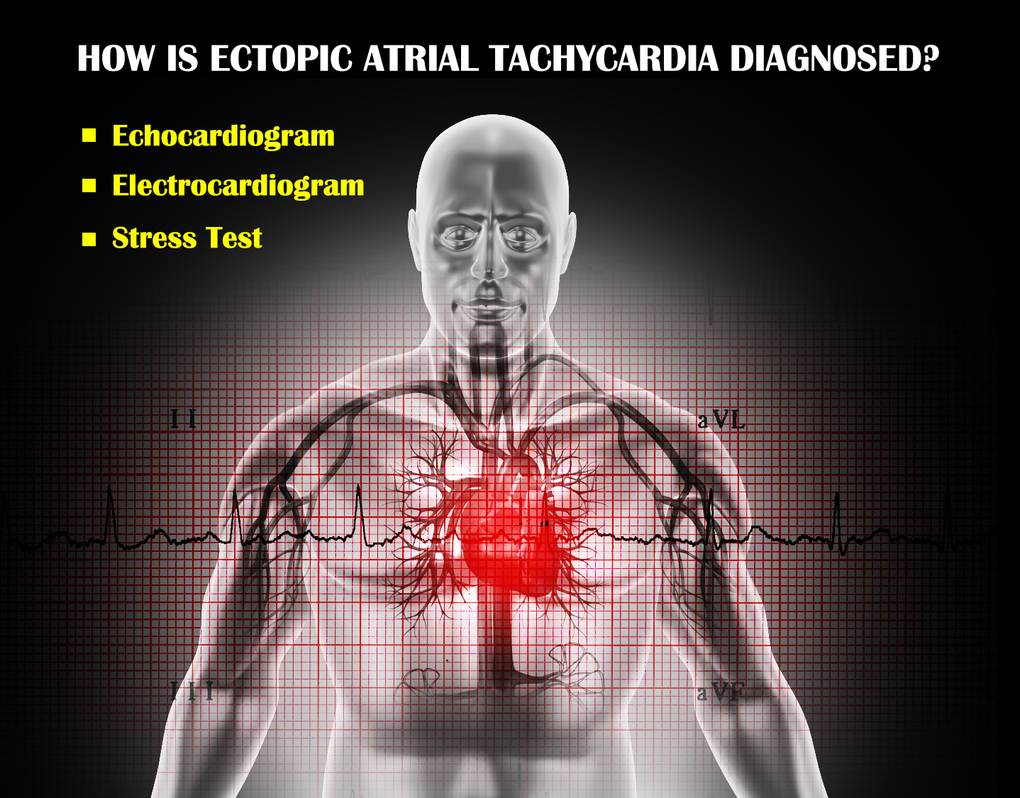 How is Ectopic Atrial Tachycardia Diagnosed