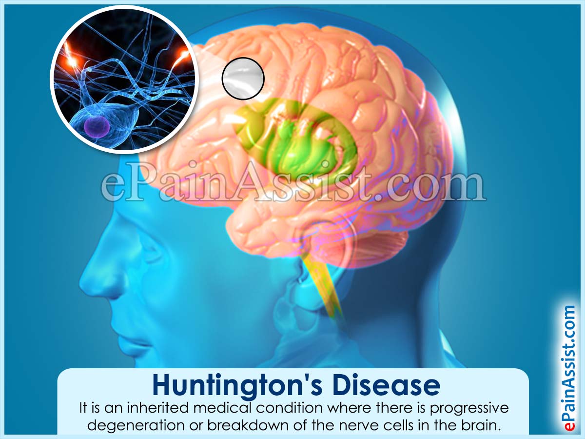 Huntington’s Disease