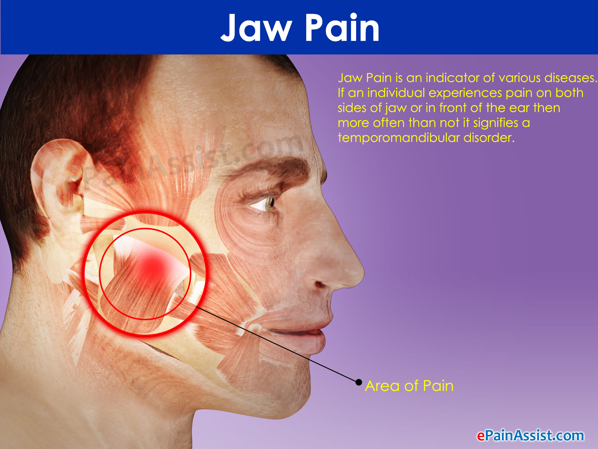 Jaw Pain