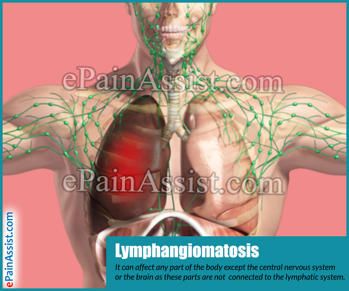 Lymphangiomatosis