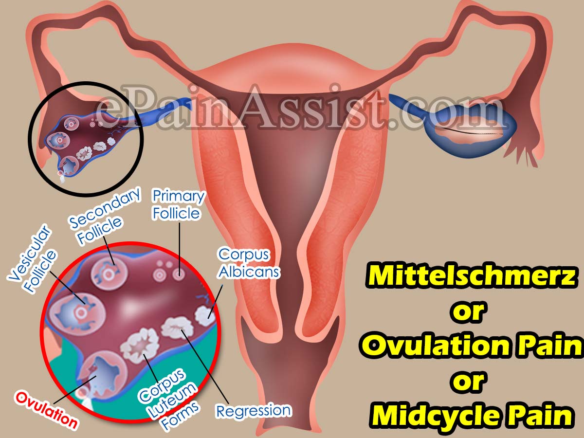 Mittelschmerz Or Ovulation Pain Or Midcycle Pain Causes Signs