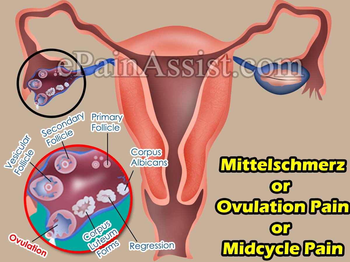 Mittelschmerz or Ovulation Pain or Midcycle Pain