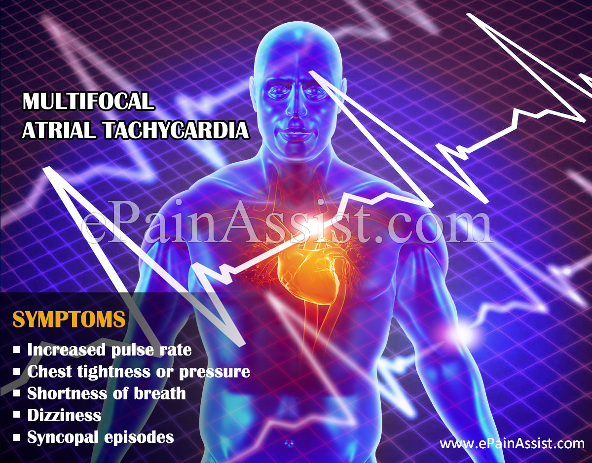 Symptoms of Multifocal Atrial Tachycardia