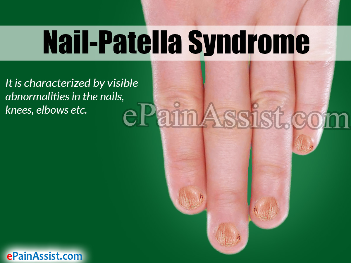 Nail-Patella Syndrome