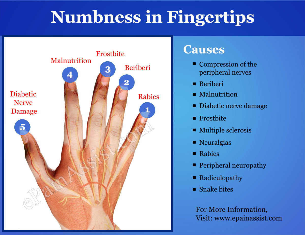 Causes of Numbness in Fingertips Causes of Numbness in Fingertips