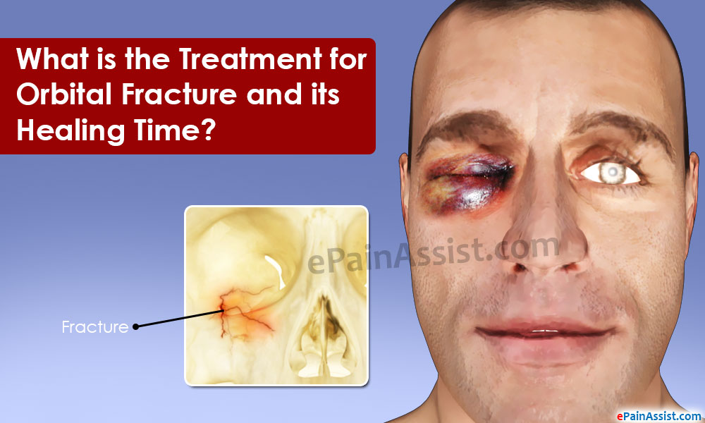 What Is The Treatment For Orbital Fracture And Its Healing Time