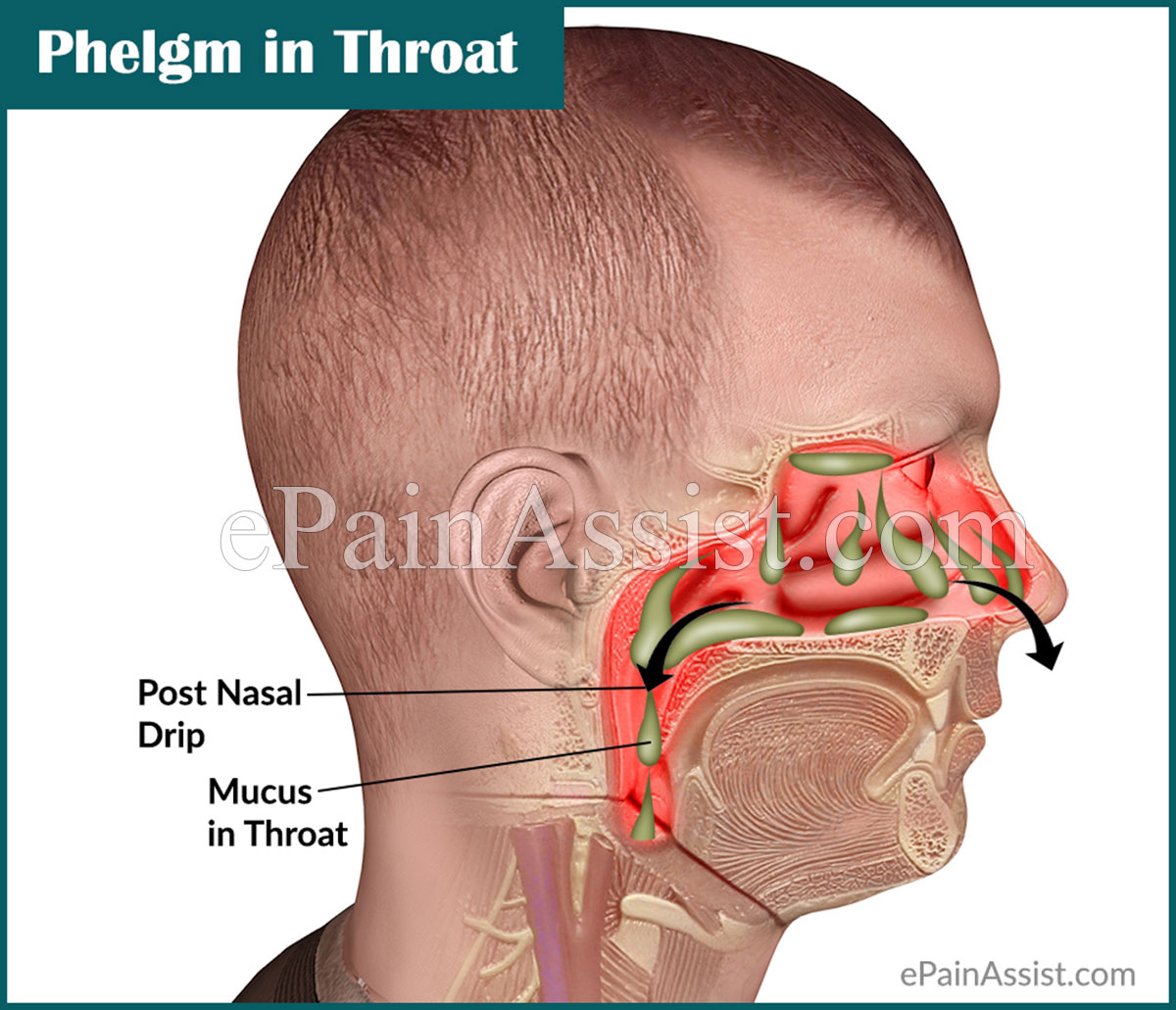 Phlegm in Throat or Mucus in Throat