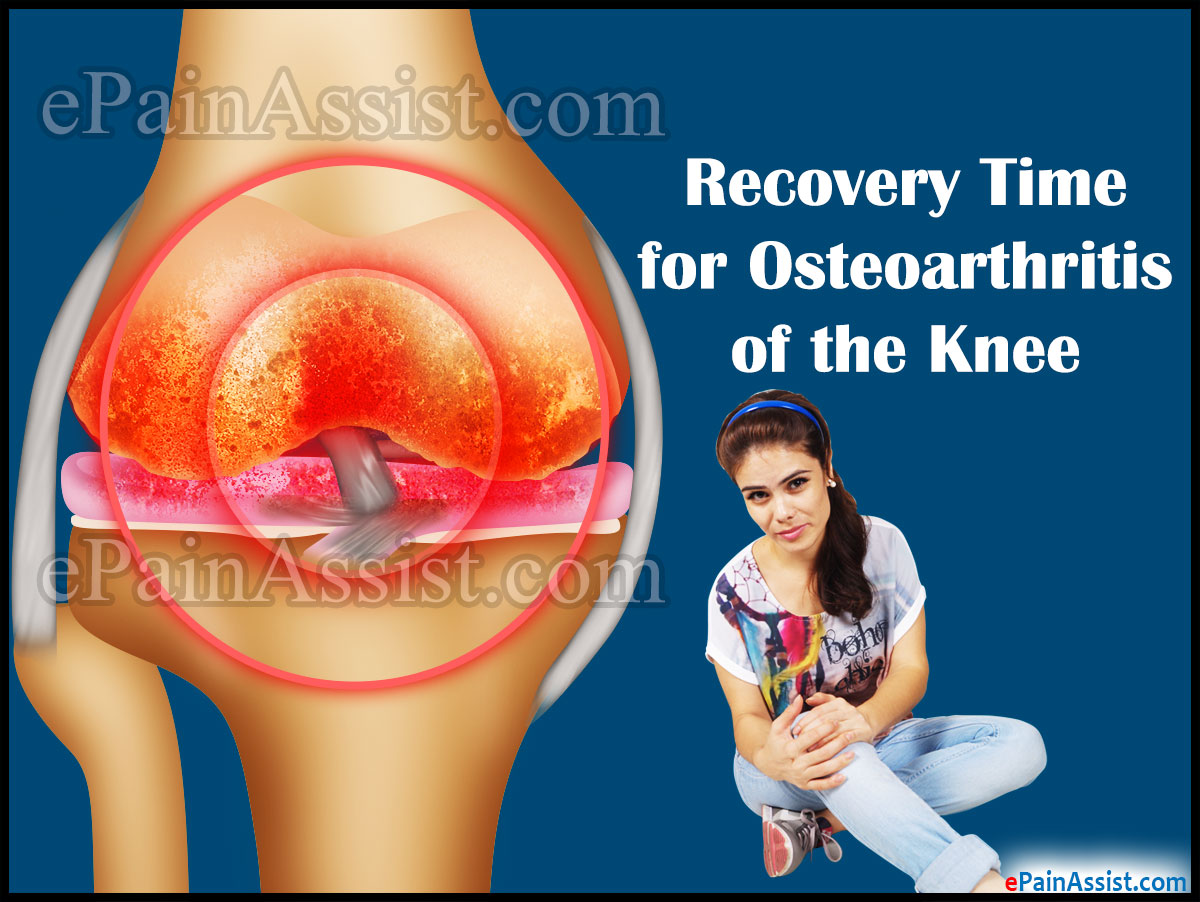 Recovery Time for Osteoarthritis of the Knee Recovery Time for Osteoarthritis of the Knee