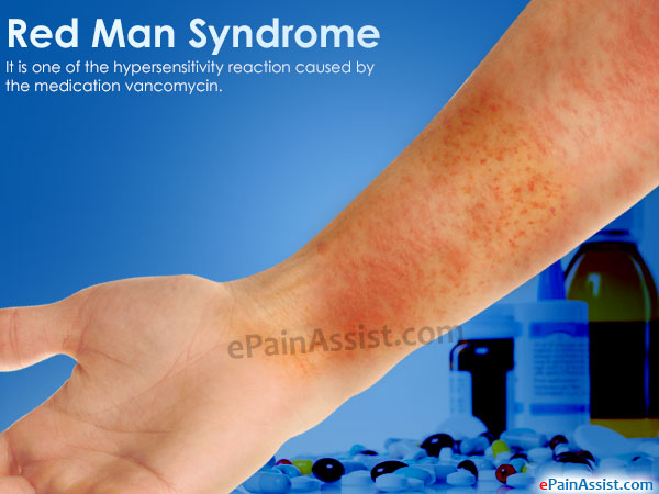 red man syndrome