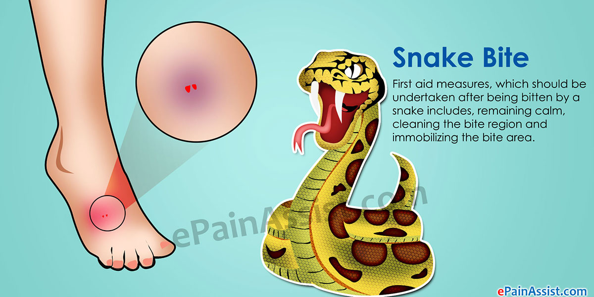 Symptoms Of Copperheads Snake Bites Symptoms Of Copperheads Snake Bites