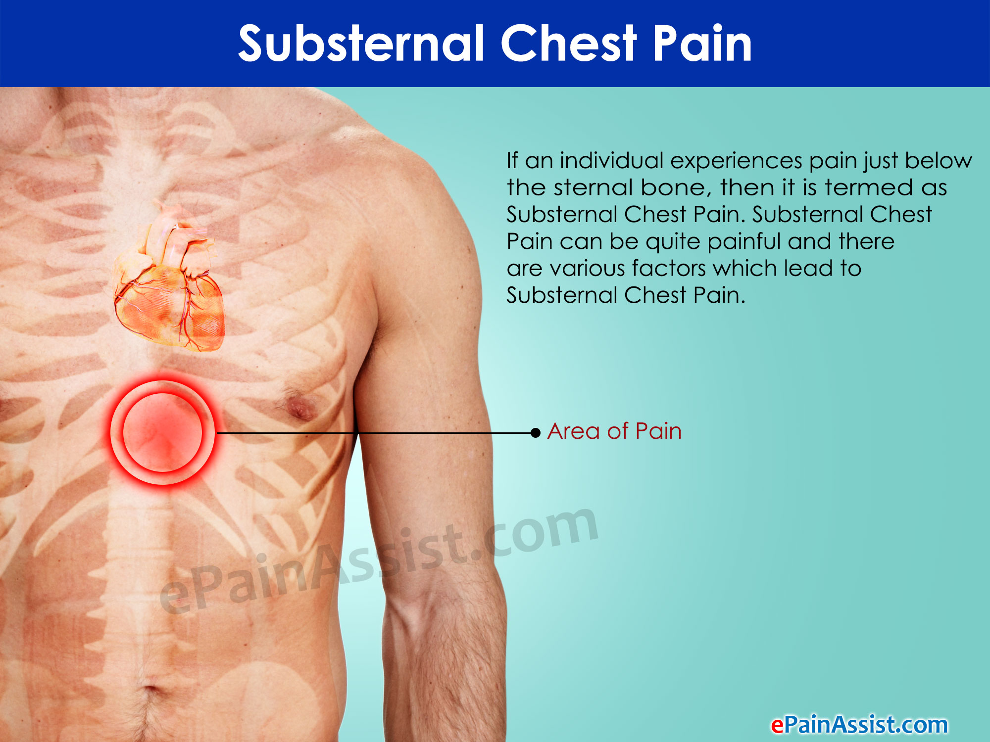 Substernal Chest Pain|Causes|Symptoms|Treatment|Diagnosis