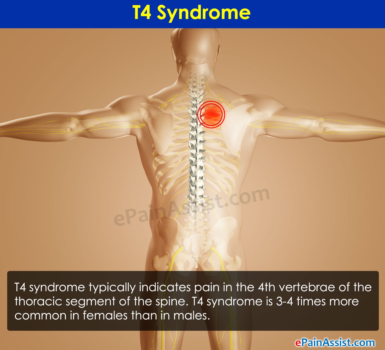 What are some treatment options for chronic thoracic spine pain?