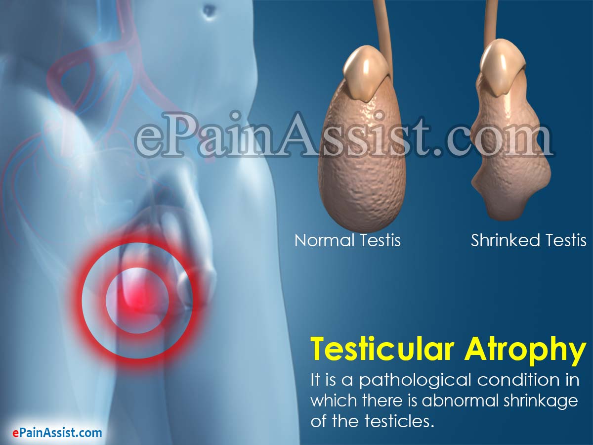 Testicular Atrophy