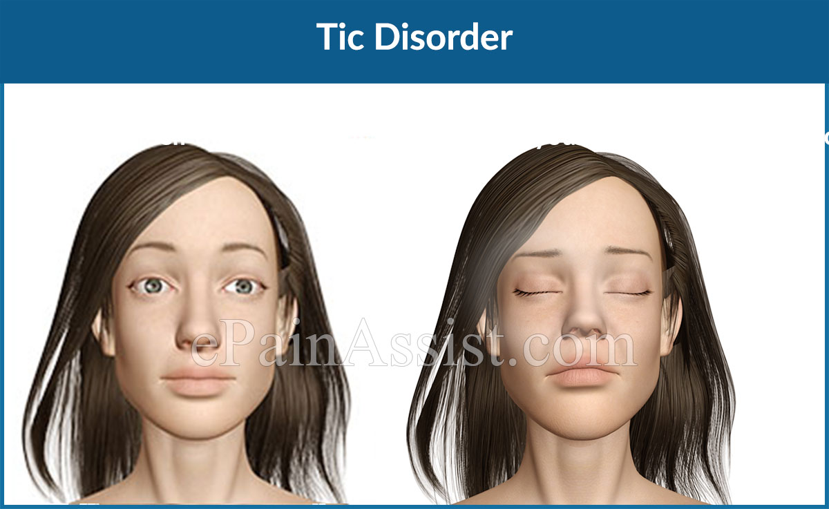 Tic Disorder|Causes|Signs|Symptoms|Treatment|Diagnosis