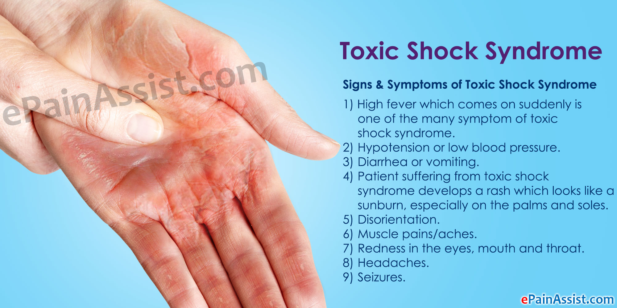 toxic shock symptoms