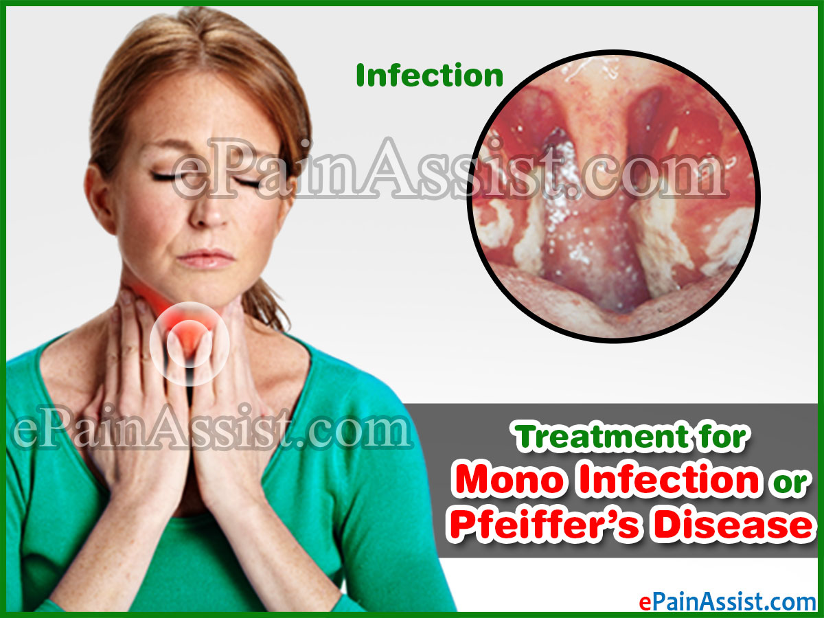 Treatment for Mono Infection or Pfeiffer’s Disease Treatment for Mono Infection or Pfeiffer’s Disease