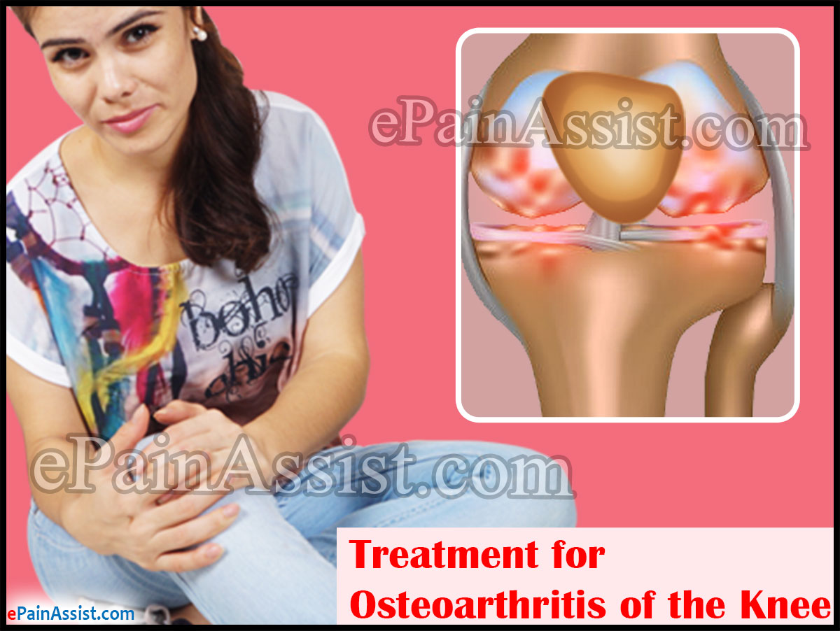Treatment for Osteoarthritis of the Knee Treatment for Osteoarthritis of the Knee
