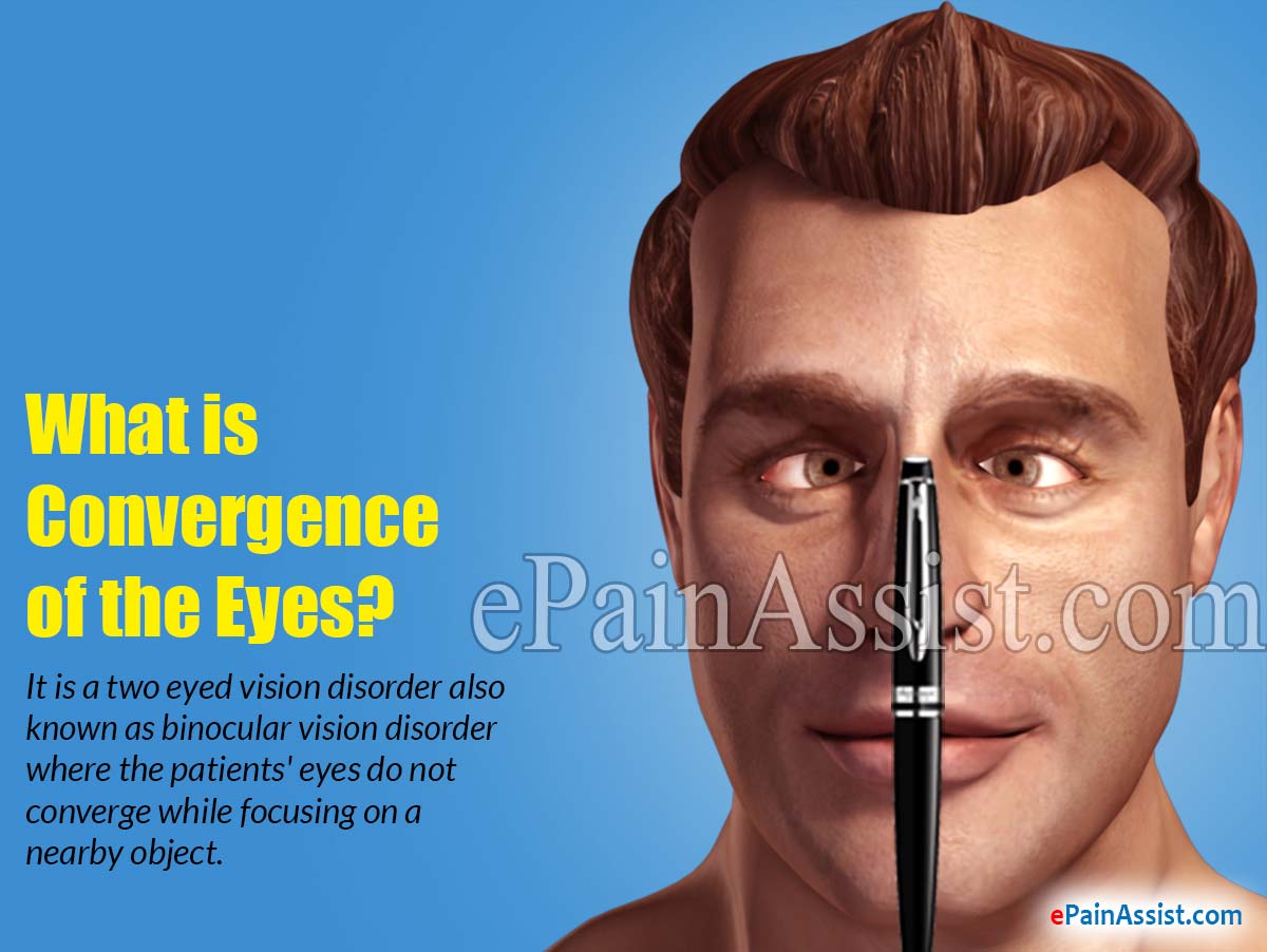 What is Convergence of the Eyes What is Convergence of the Eyes