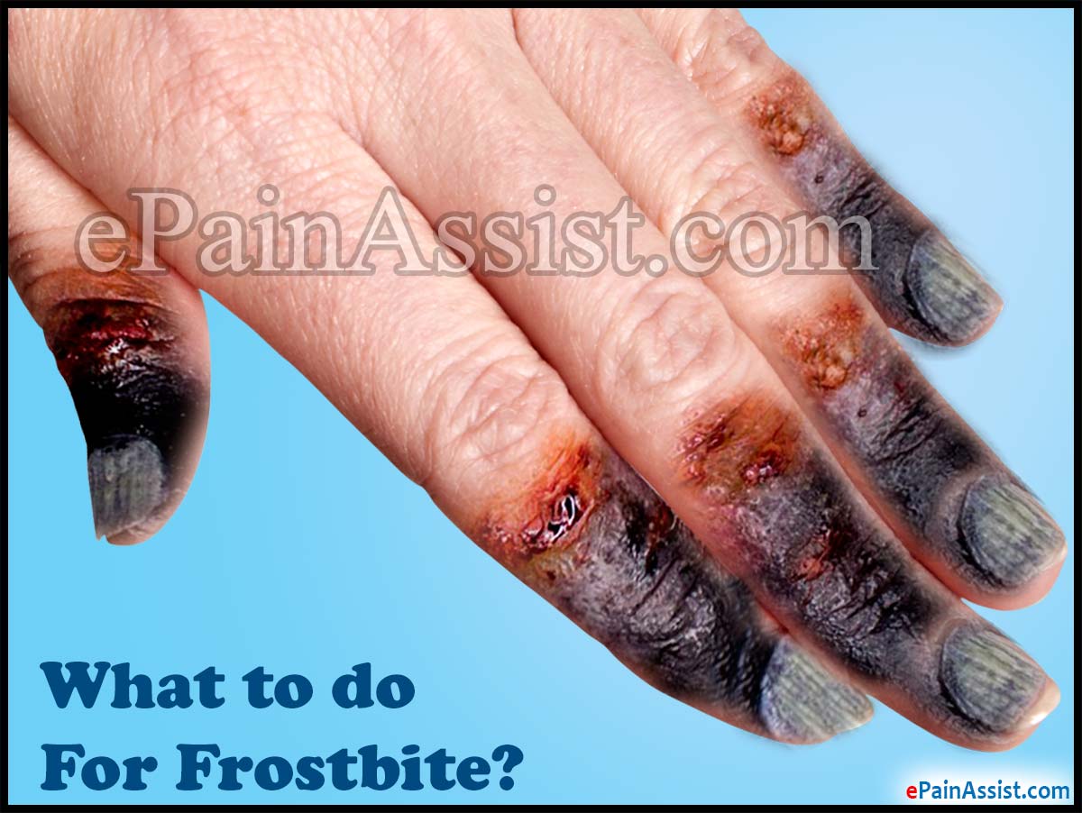 What to do For Frostbite