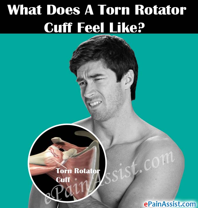 What Does A Torn Rotator Cuff Feel Like?