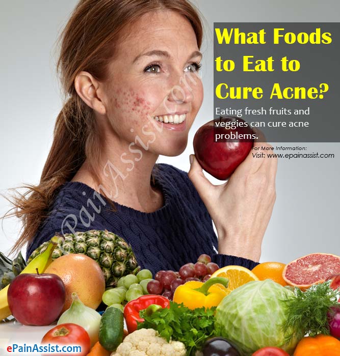 What Foods to Eat to Cure Acne?