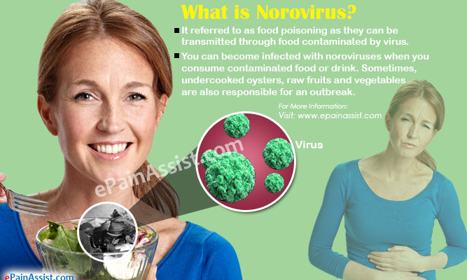 What is Norovirus