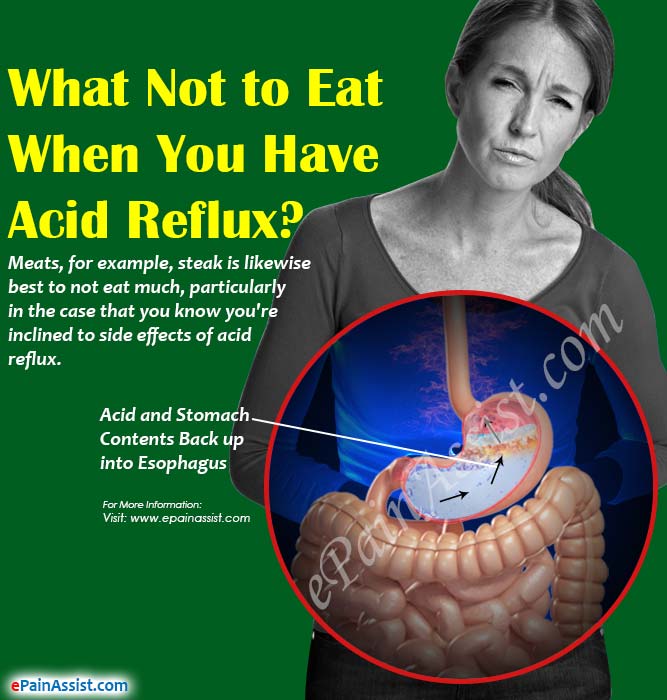 What Not to Eat When You Have Acid Reflux?