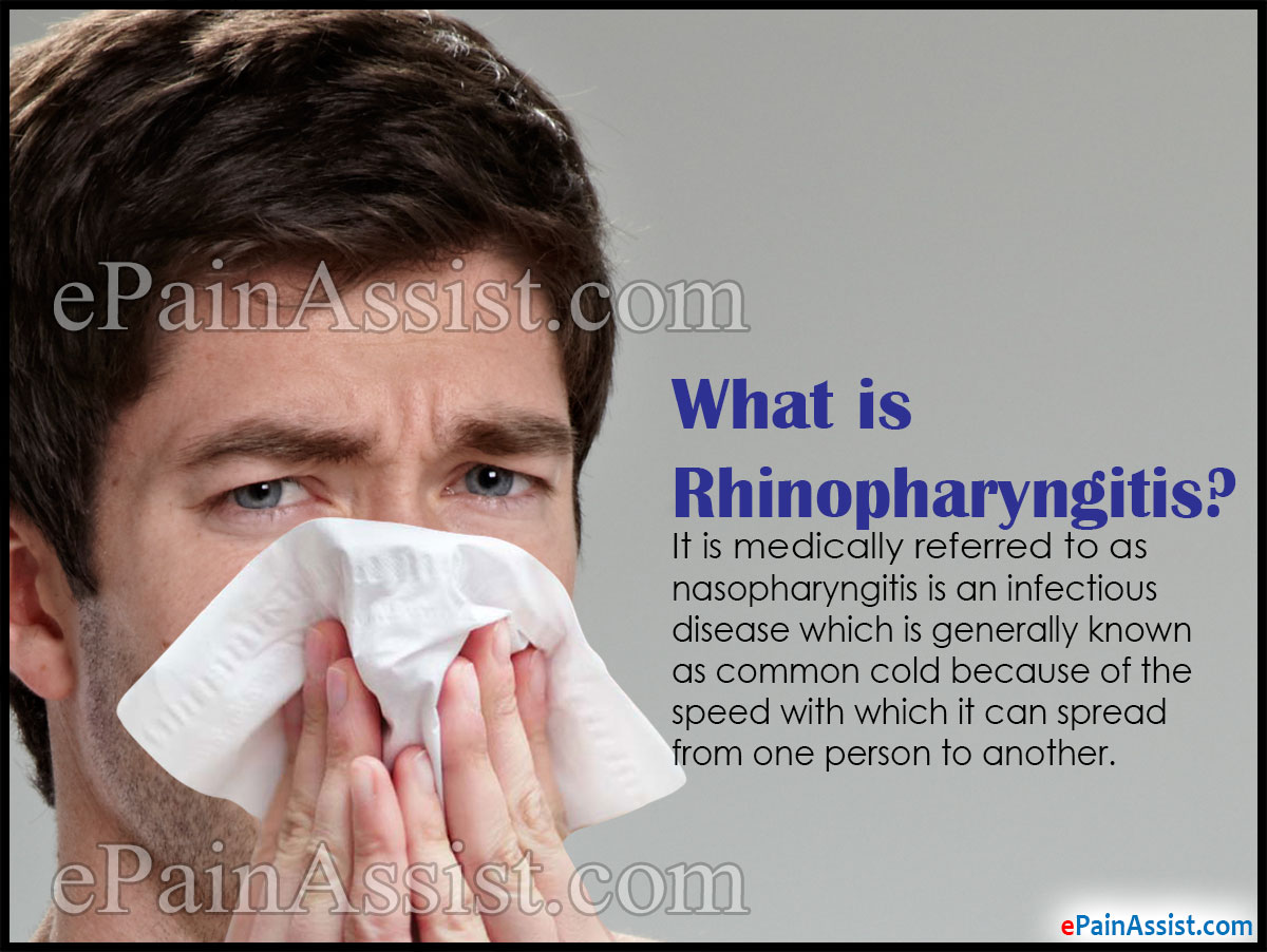 What is Rhinopharyngitis or Acute Coryza What is Rhinopharyngitis or Acute Coryza