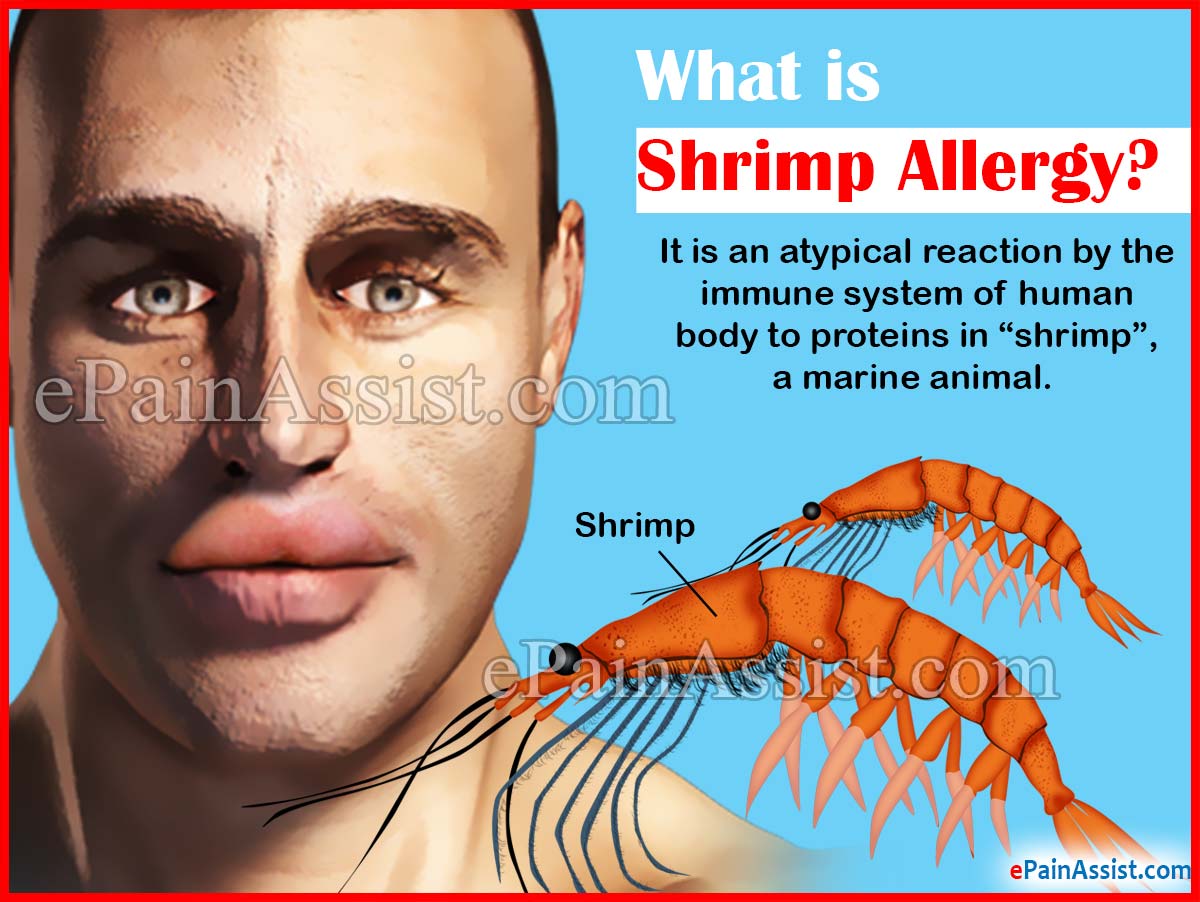 What is Shrimp Allergy