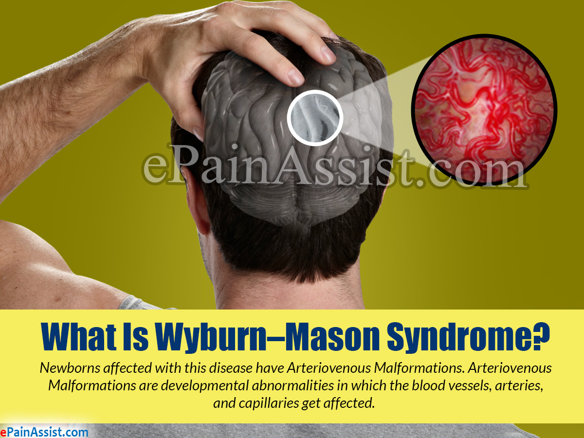 What is Wyburn-Mason Syndrome
