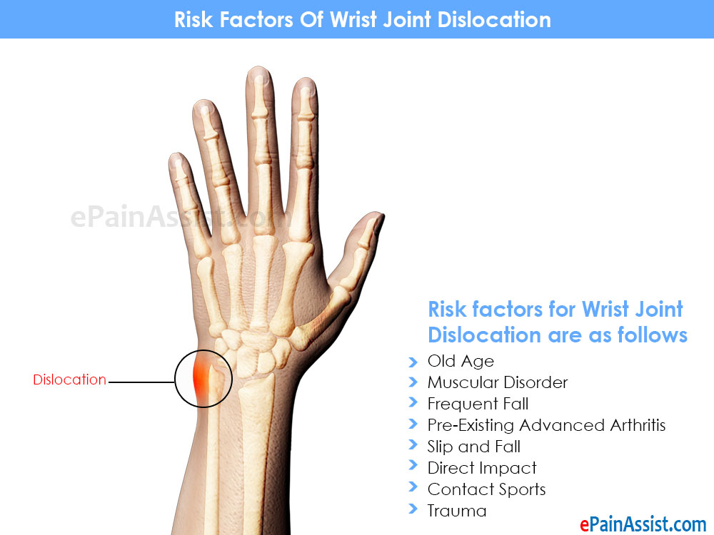 Risk Factors Of Wrist Joint Dislocation