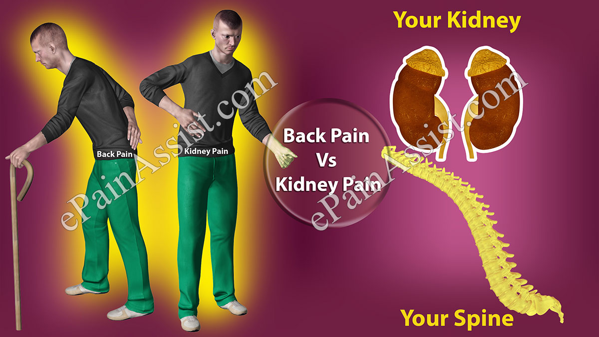 Back Pain Vs Kidney Pain Back Pain Vs Kidney Pain