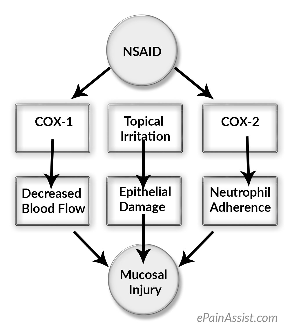 Can NSAIDs Cause Peptic Ulcer Disease? Can NSAIDs Cause Peptic Ulcer Disease?