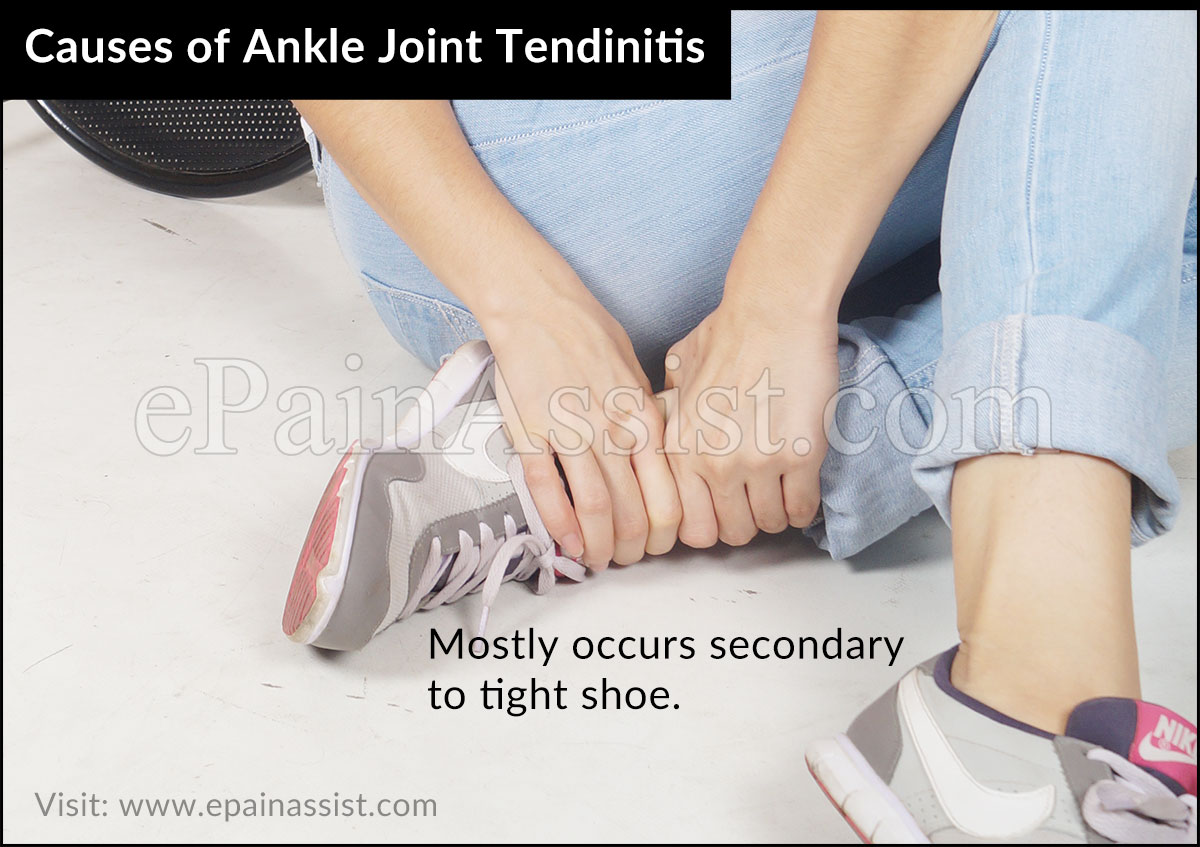 causes of Ankle Joint Tendinitis causes of Ankle Joint Tendinitis