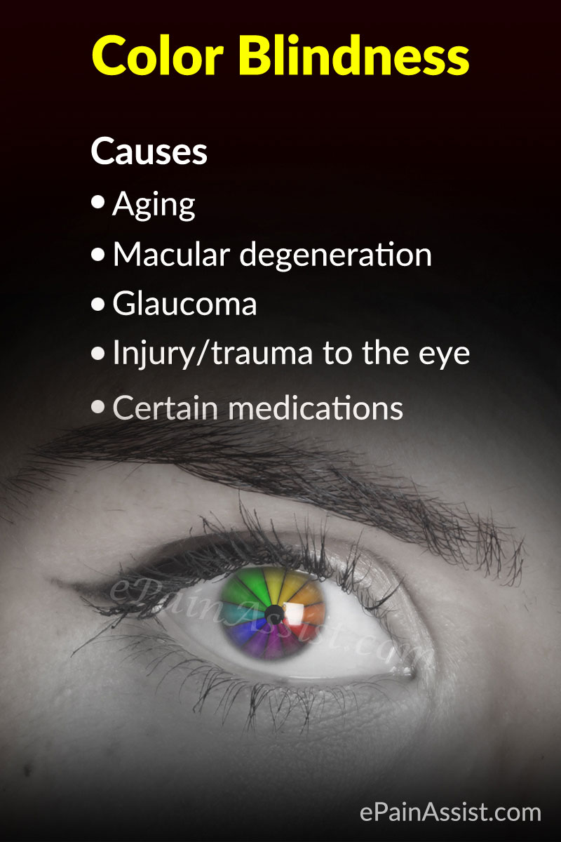 Color Blindness Or Color Vision Deficiency Causes Symptoms Tests Treatment Color Blindness Or Color Vision Deficiency Causes Symptoms Tests Treatment