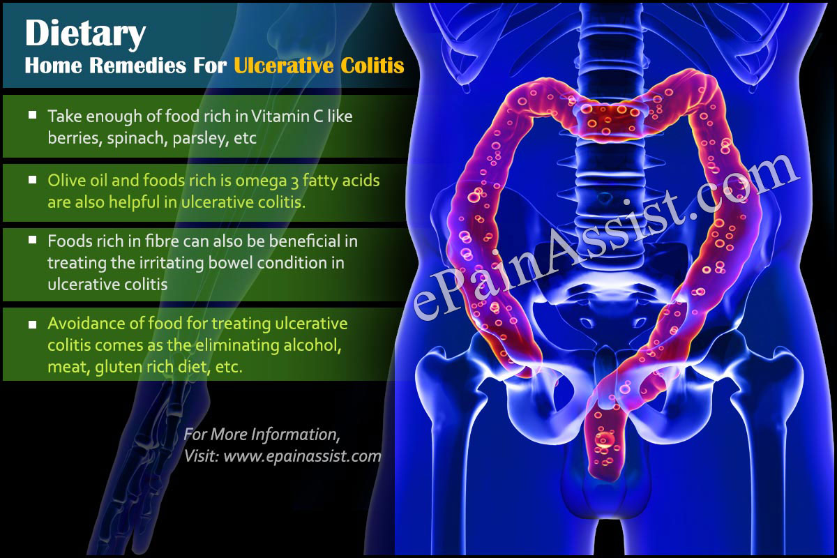 Dietary Home Remedies For Ulcerative Colitis Dietary Home Remedies For Ulcerative Colitis