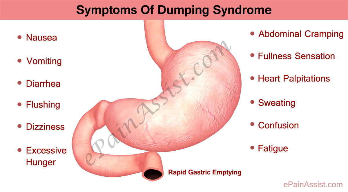 Dumping Syndrome