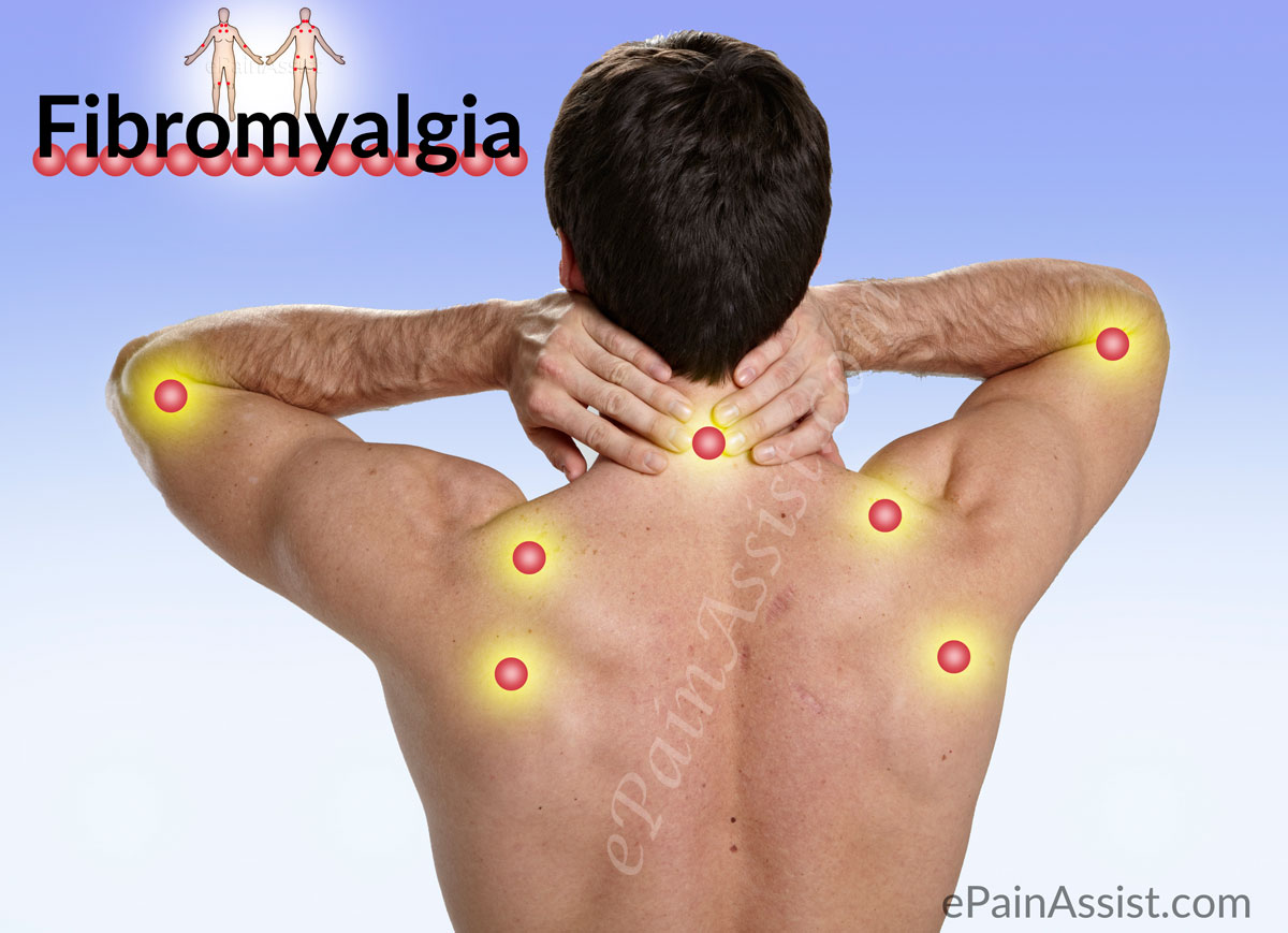 Fibromyalgia (FM or FMS)