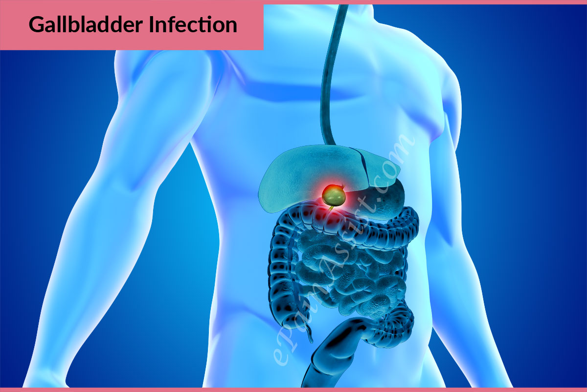 Gall bladder infection symptoms mayo clinic, ed treatments diabetes uk