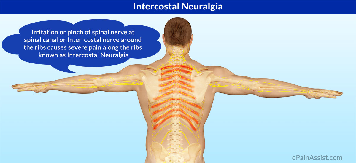 Muscle And Nerves Between Ribs 49