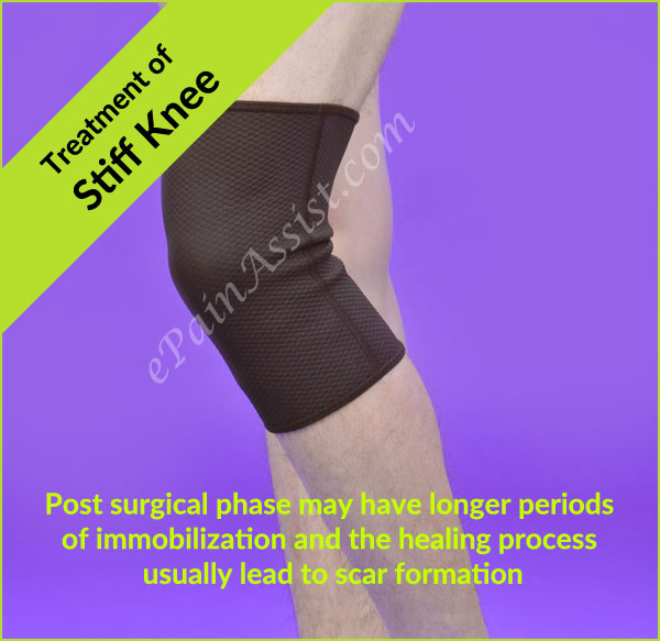 Stiff Knee After Surgery Stiff Knee After Surgery
