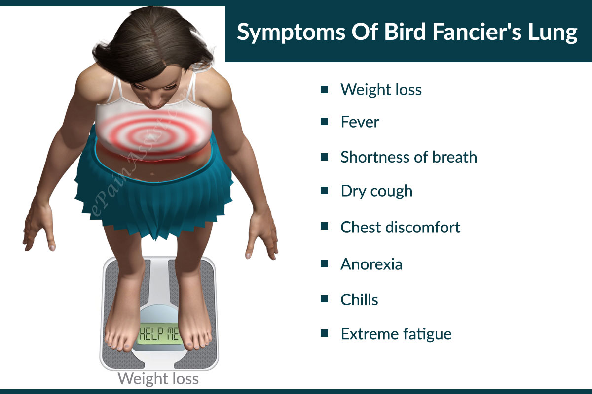 Symptoms Of Bird Fancier’s Lung
