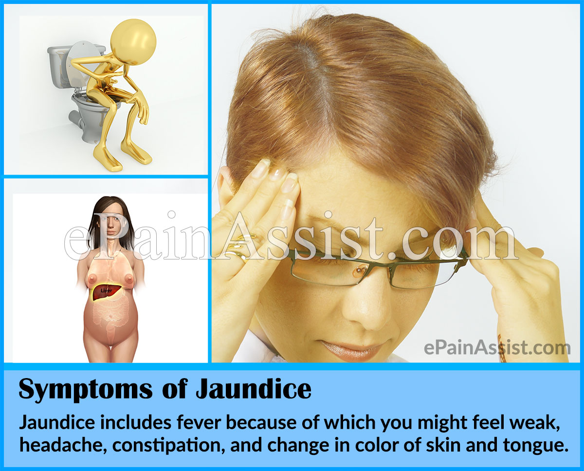 Symptoms of Jaundice