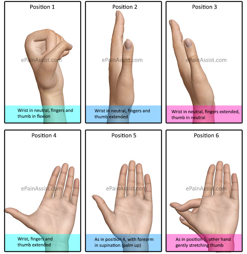 Intrinsic Supervised Physiotherapy Stretches For Ulnar Deviation or Ulnar Drift