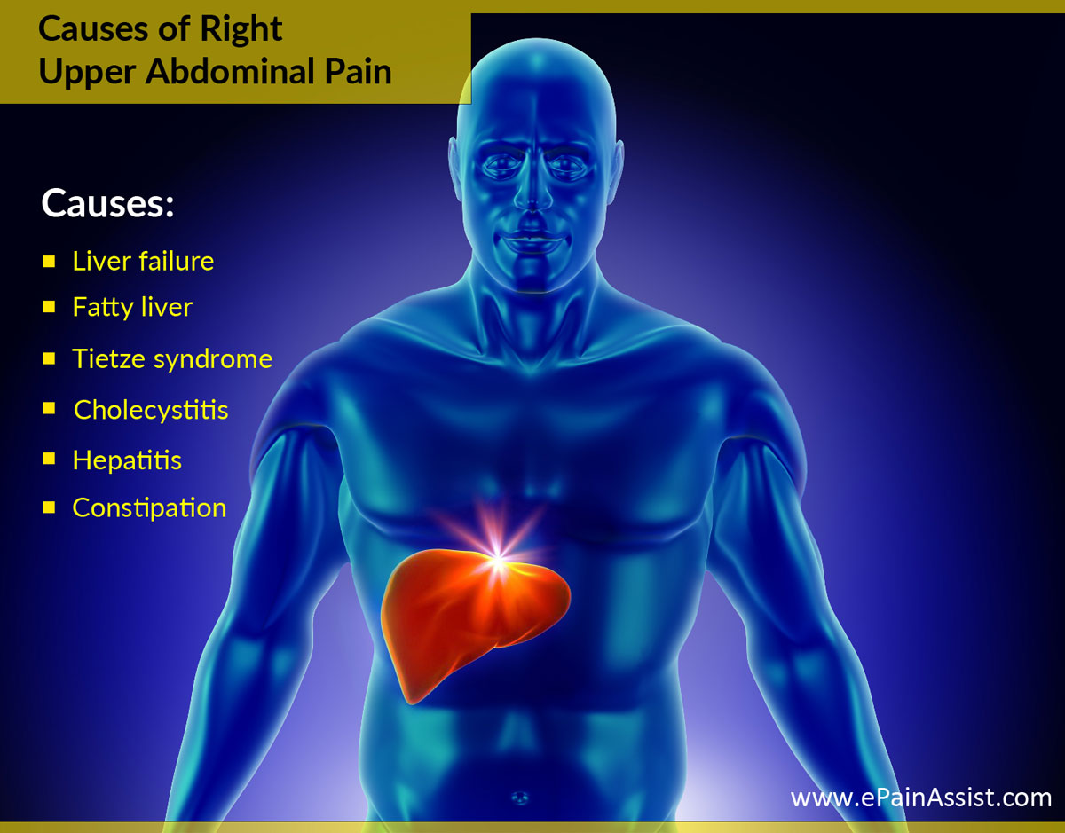 What Can Cause Upper Abdominal Pain