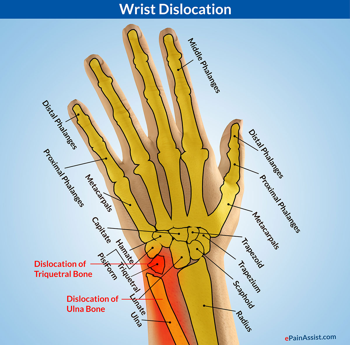 Wrist Ligaments Diagram