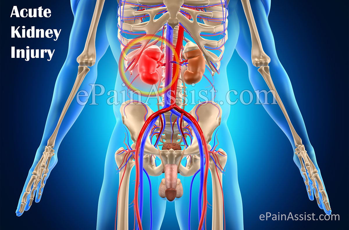 Acute Kidney Disease Acute Kidney Disease