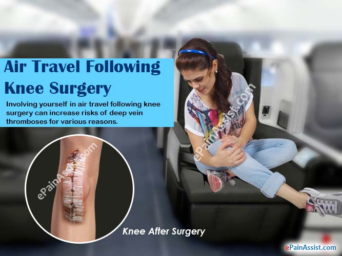 Air Travel Following Knee Surgery