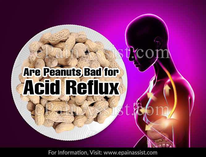 Are Peanuts Bad For Acid Reflux?