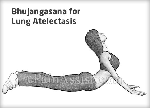 Bhujangasana for Lung Atelectasis